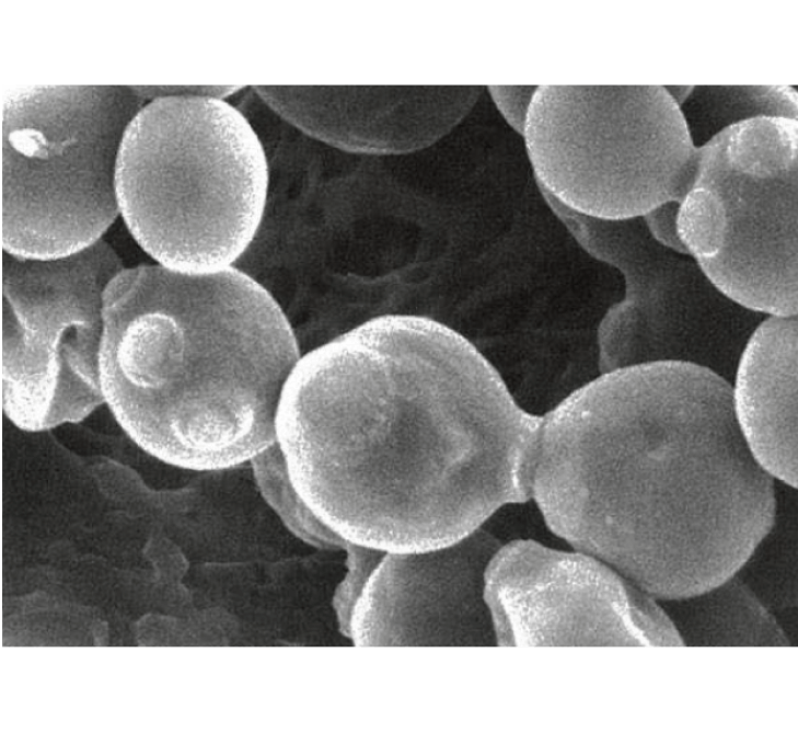 図5. 酵母の電子顕微鏡写真（写真：元うすき生物科学研究所所長 久米堯様 撮影）