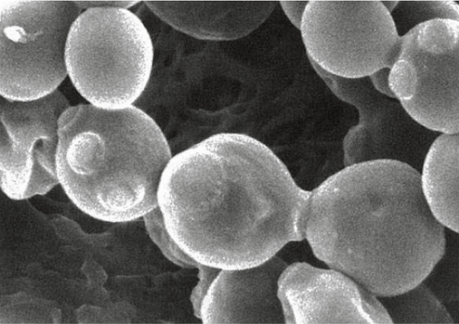 図5. 酵母の電子顕微鏡写真（写真：元うすき生物科学研究所所長 久米堯様 撮影）